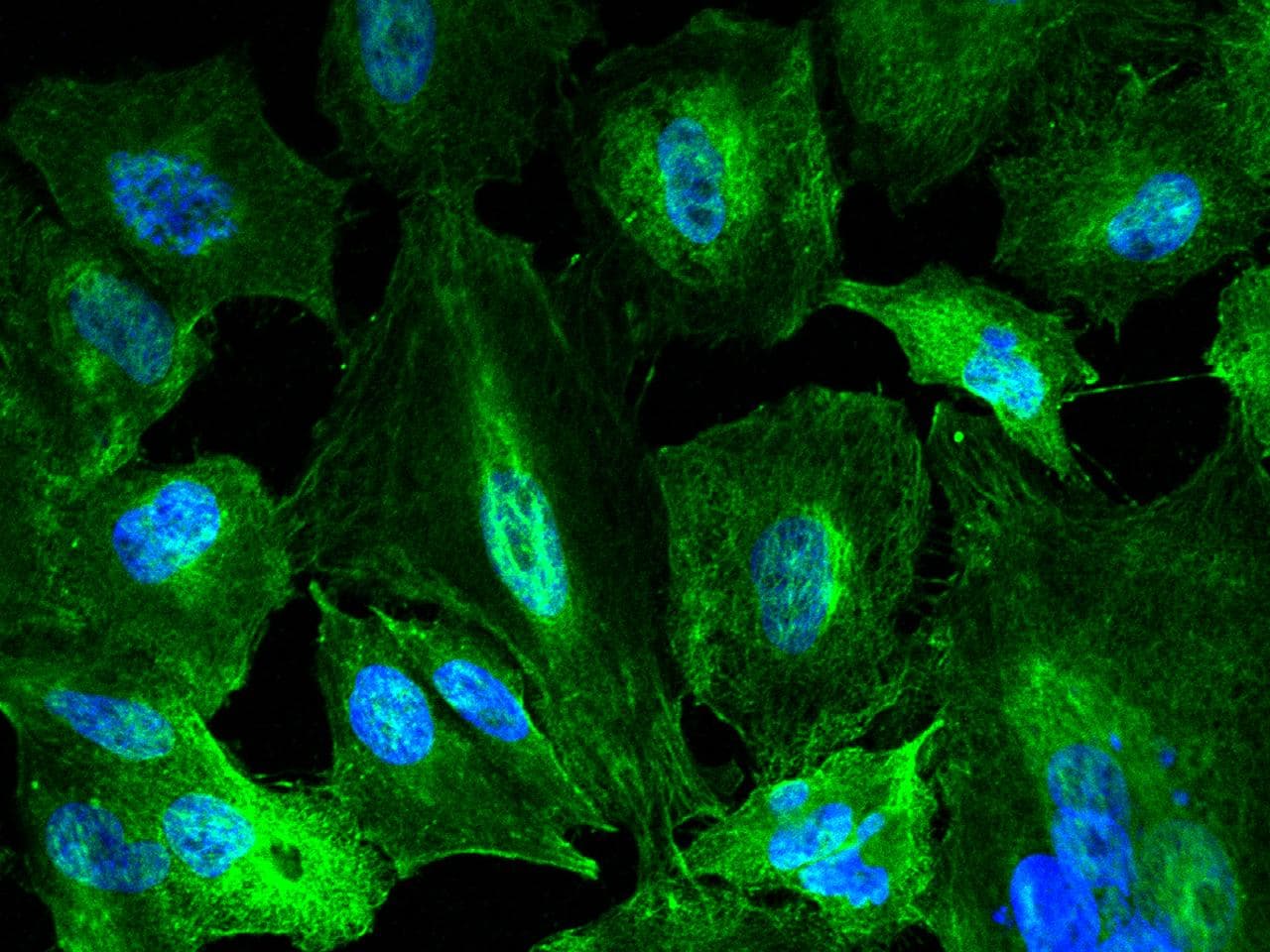 KYNU Antibody (clone 062, Preservative Free)