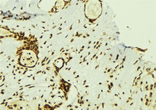 Polyclonal Rabbit anti-Human ZNF638 Antibody (IHC, IF, WB)