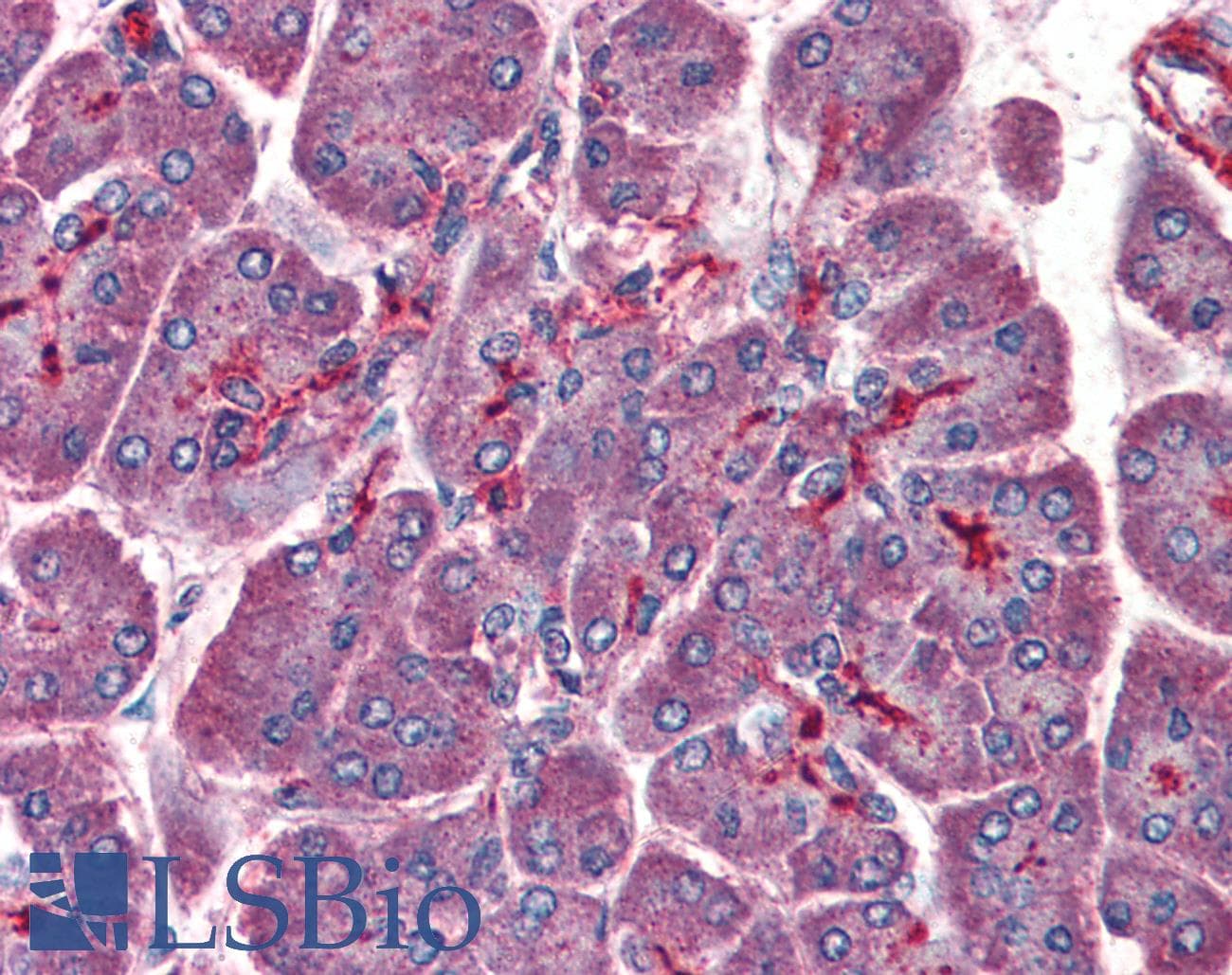 IHC-plus™ Polyclonal Goat anti-Human PAFAH1B1 / LIS1 Antibody (aa397-410, IHC, WB)