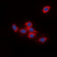 Polyclonal Rabbit anti-Human DOK2 Antibody (Internal, IHC, IF, WB)