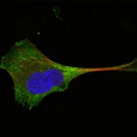 WNT10B Antibody (clone 5A7)