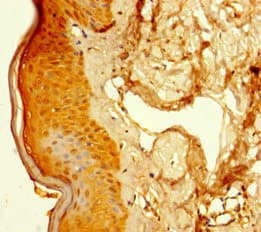 SUPT16H / FACTP140 Antibody