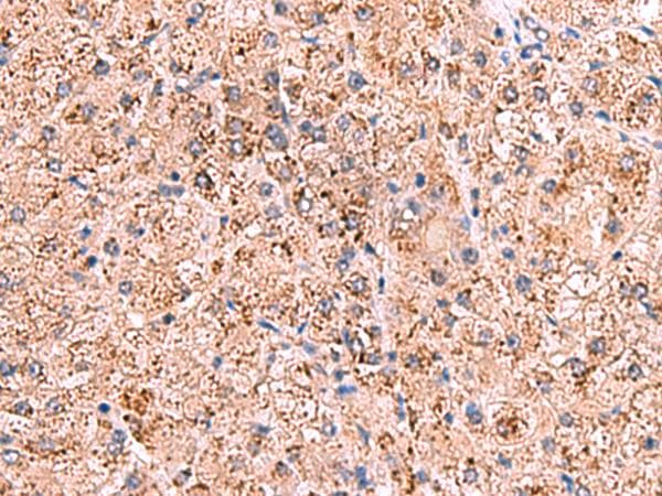 OSBPL2 Antibody