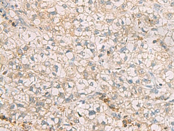 SLC30A6 Antibody