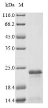 Human FXYD3 Protein (Recombinant 6His-SUMO, N-terminus)