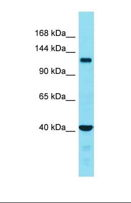 FAM65A Antibody (aa284-333)