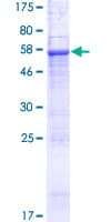 Human SEC22C Protein (Recombinant GST)