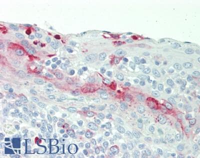 IHC-plus™ Polyclonal Rabbit anti-Human IL3 Antibody (Internal, IHC, WB)