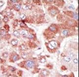 GRK7 / GPRK7 Antibody (aa508-538)
