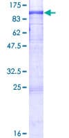 Human DYRK1B Protein (Recombinant GST)