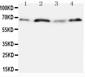 SPP1 / Osteopontin Antibody (aa28-47)