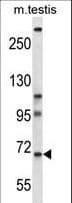 PAN3 Antibody (aa727-755)
