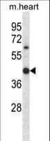 HOXC11 Antibody (aa1-30)