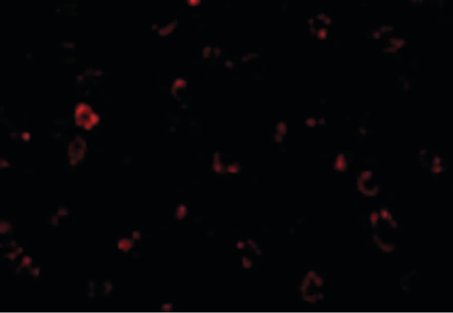 Polyclonal Rabbit anti-Human CX3CR1 Antibody (IHC, IF, WB)