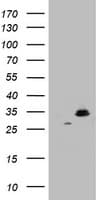 Monoclonal Mouse anti-Human HADH Antibody (clone OTI1E6, aa57-314, IHC, WB)