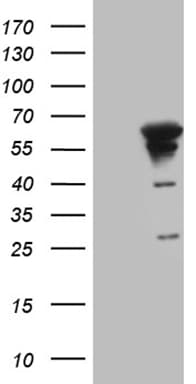 MYOT / Myotilin Antibody (clone OTI10A11)