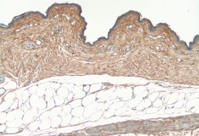 COL1A1 / Collagen I Alpha 1 Antibody