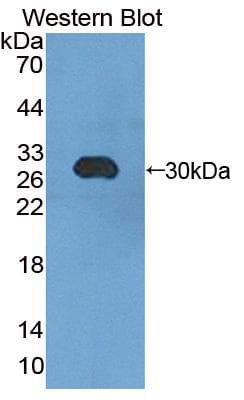 CHGB / Chromogranin B Antibody (PE)