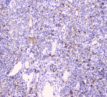 Polyclonal Rabbit anti-Human CDA / Cytidine Deaminase Antibody (IHC, WB)