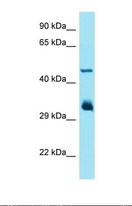 Polyclonal Rabbit anti-Human IFIT1 / ISG56 Antibody (aa100-148, WB)