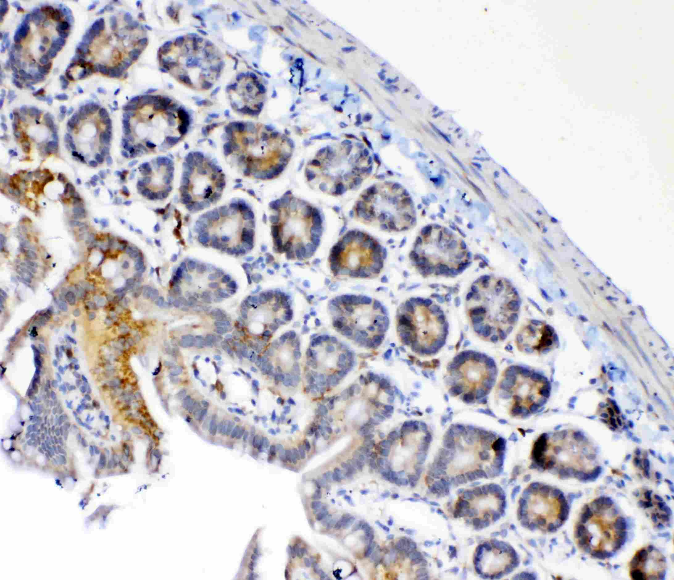 Polyclonal Rabbit anti-Human FH / Fumarase / MCL Antibody (IHC, WB)