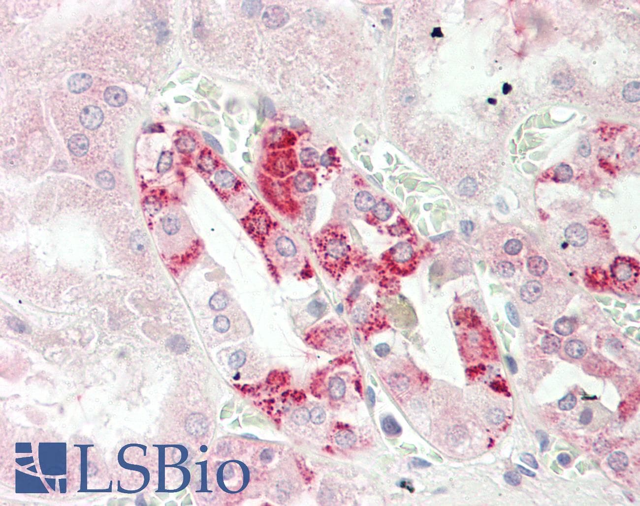 CUTA Antibody (aa71-120)