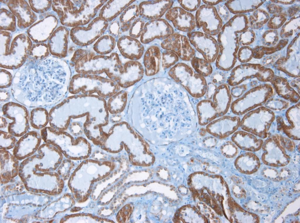 IHC-plus™ CDH6 / K Cadherin Antibody (clone 2B6)