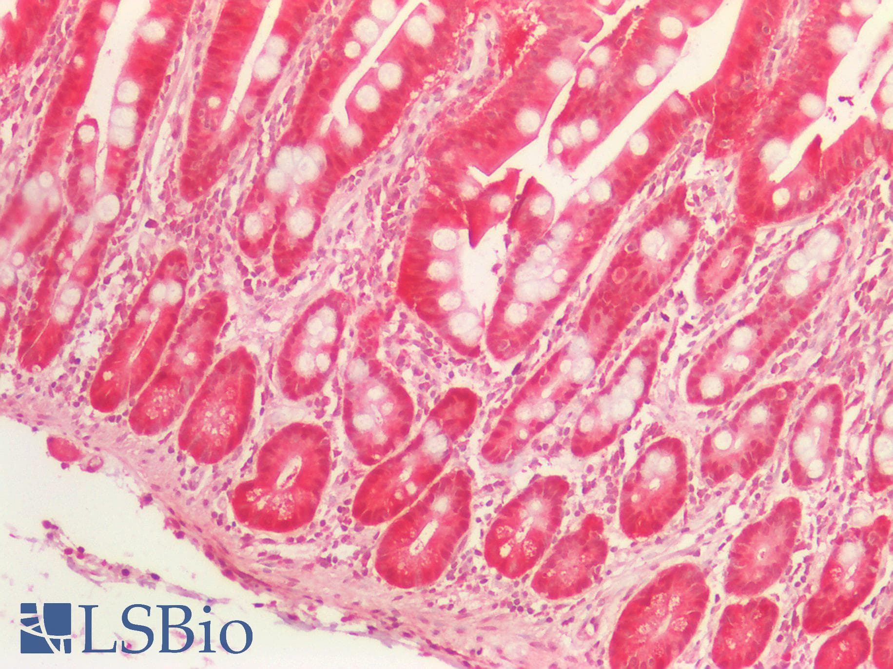PathPlus™ SERPINB5 / Maspin Antibody