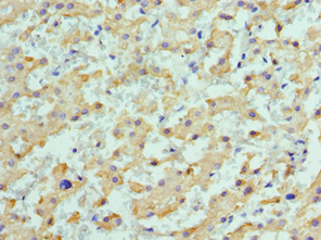 Polyclonal Rabbit anti-Human ALDH1L1 Antibody (aa1-250, IHC, WB)