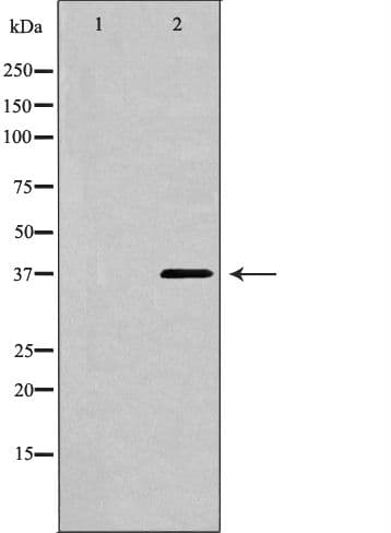 CTGF Antibody