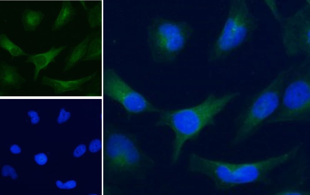 IHC-plus™ Polyclonal Goat anti-Human GAPDH Antibody (aa279-290, IHC, IF, WB)