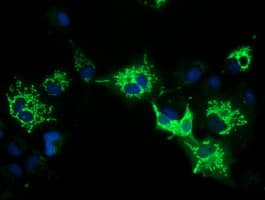 Monoclonal Mouse anti-Human P5CR2 / PYCR2 Antibody (clone OTI4A10, IF, WB)