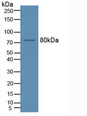SMPD1 / Acid Sphingomyelinase Antibody (aa319-579)