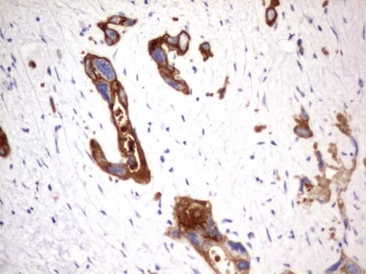 Acidic Cytokeratin Antibody (clone 3E10)