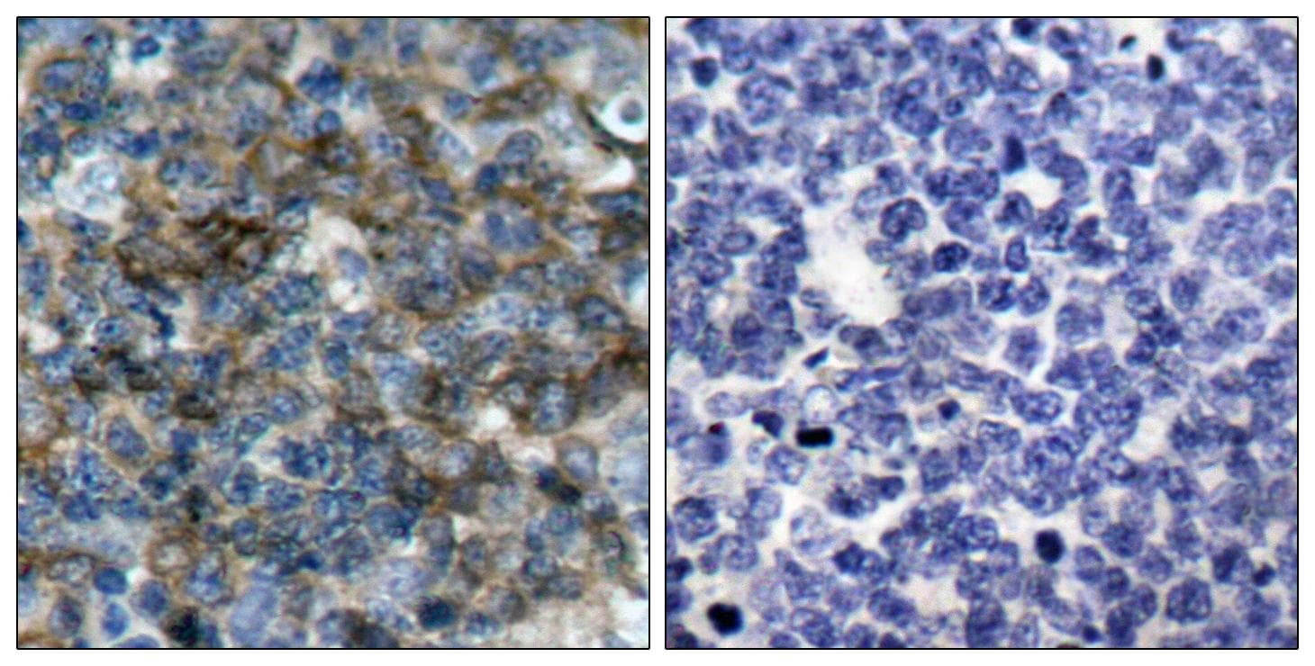 VASP Antibody (phospho-Ser157)