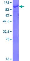 Human ZMYM3 Protein (Recombinant GST)