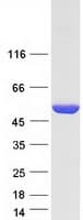 Human ASL / Argininosuccinate Lyase Protein (Recombinant Myc-DDK (Flag))