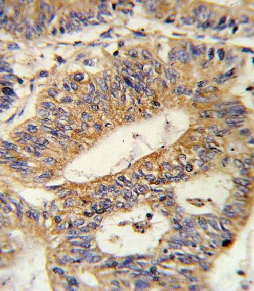 IL17RB Antibody (aa207-234)
