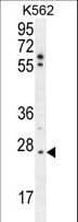 TNFAIP8 / SCC-S2 Antibody (aa50-78)