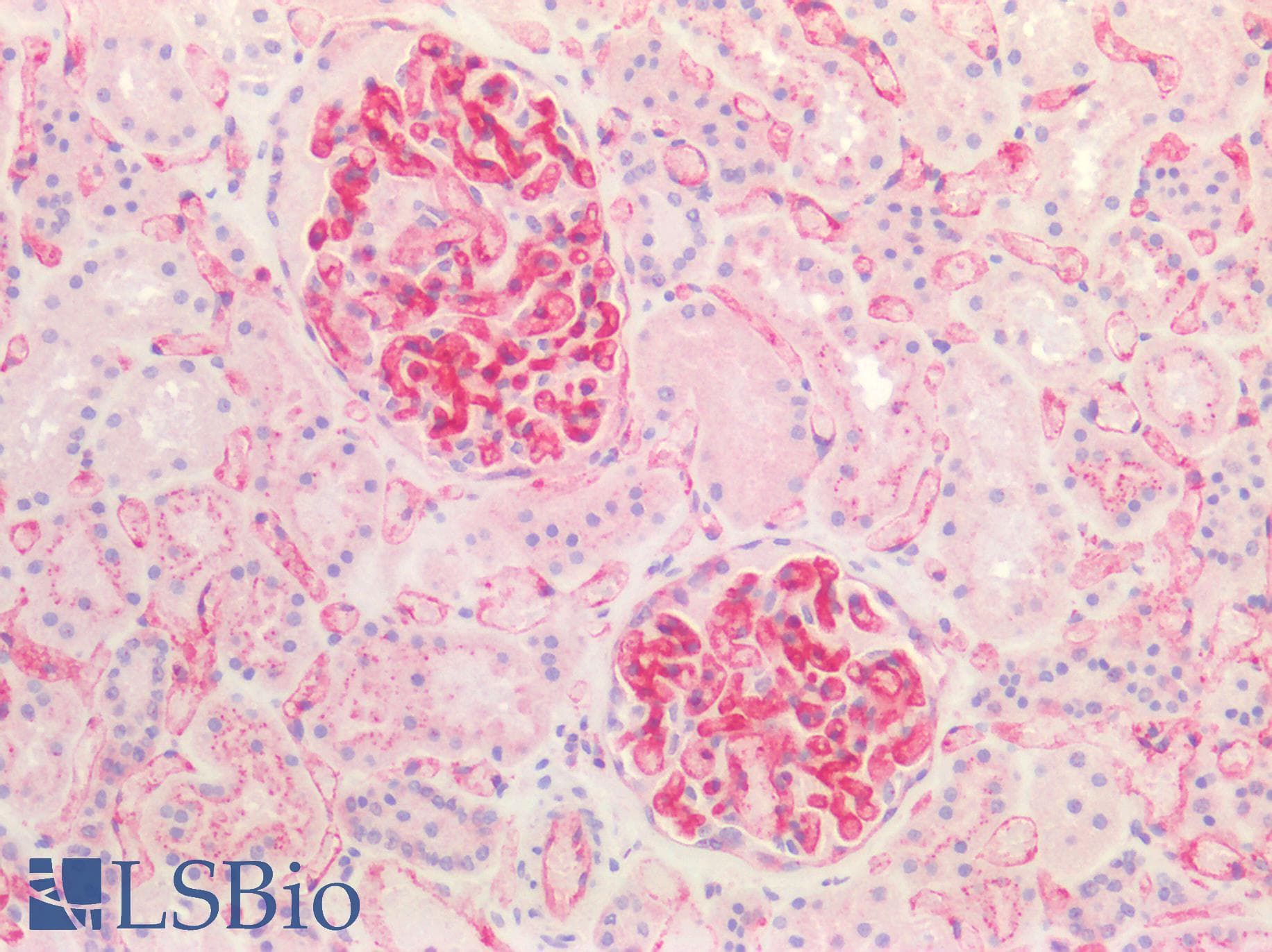 PathPlus™ B2M / Beta 2 Microglobulin Antibody (aa21-119, clone OTI1A7)
