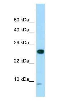 SPANXC / SPANX-C Antibody (aa20-69)