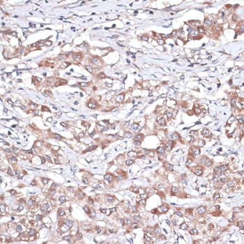 TGFBR2 Antibody