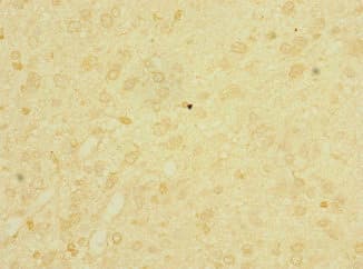 Polyclonal Rabbit anti-Human LRIG1 Antibody (IHC)