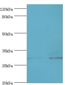 Polyclonal Rabbit anti-Human SPIN2B Antibody (aa1-258, IHC, WB)