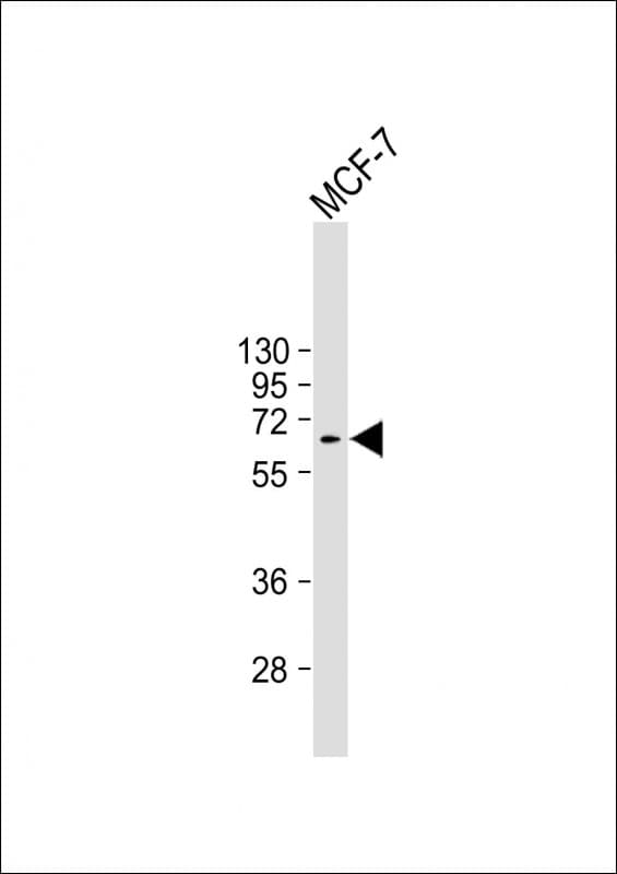 MDM2 Antibody (clone 1806CT309.52.1)