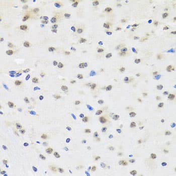 SAFB2 Antibody