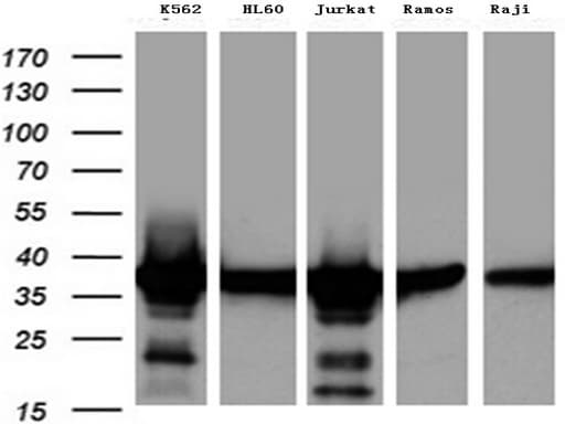 TS / Thymidylate Synthase Antibody (clone UMAB227)