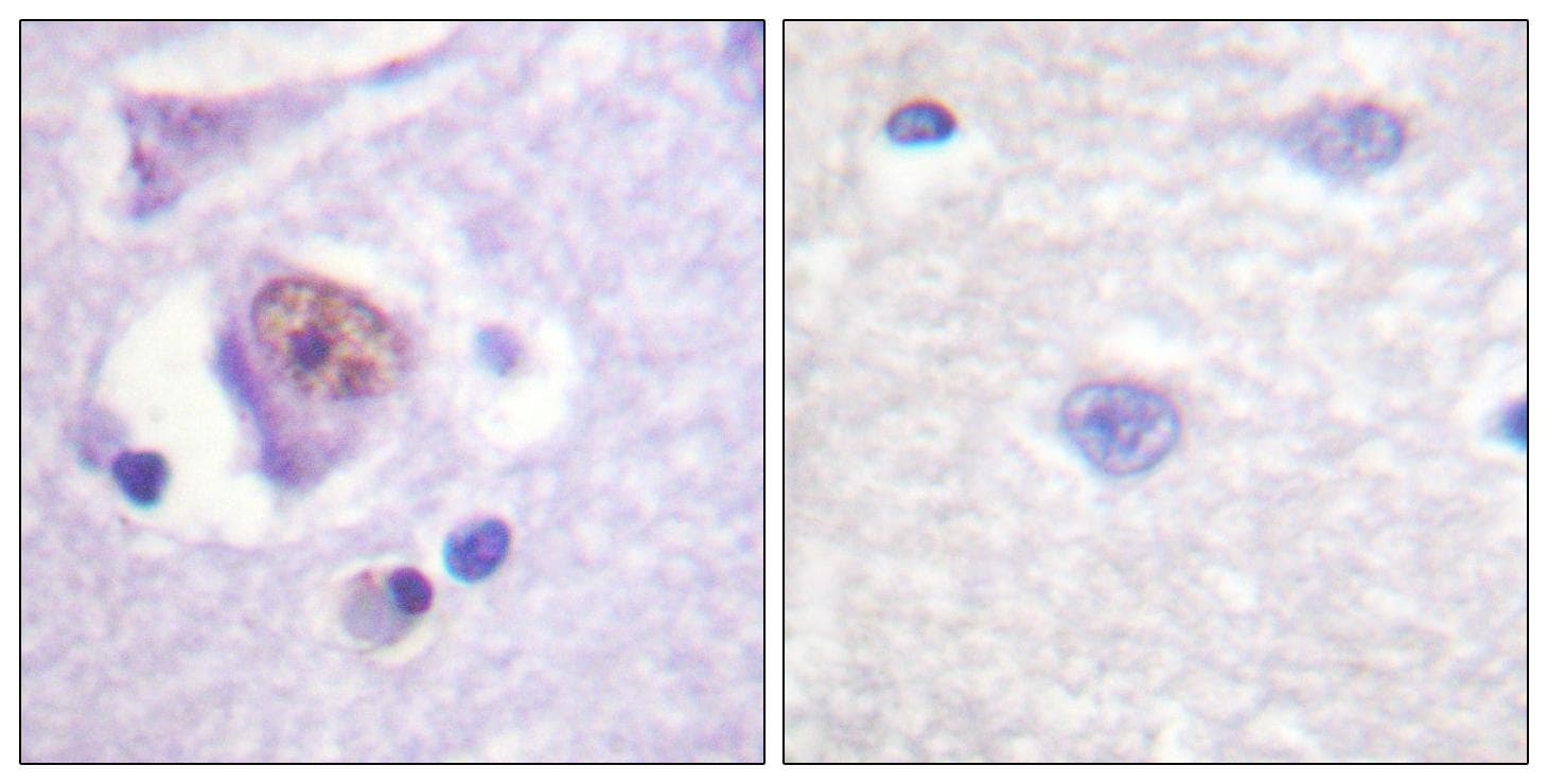 Polyclonal Rabbit anti-Human SOX9 Antibody (p181, IHC, IF, WB)