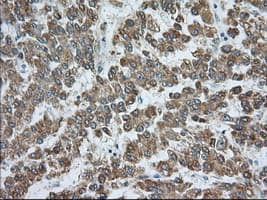 RAB17 Antibody (clone OTI5E2)