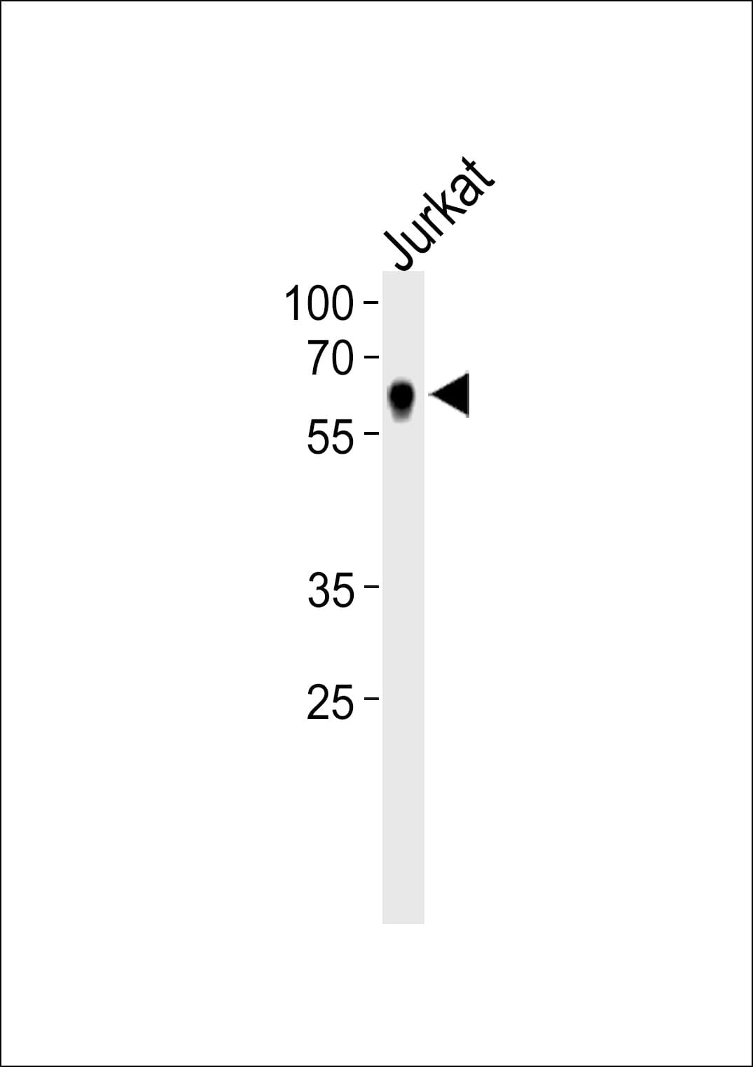 NR2C2 / TAK1 Antibody (aa438-466)